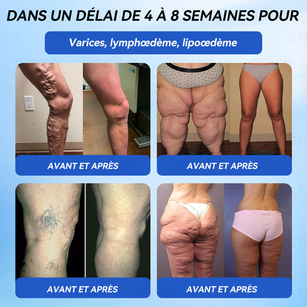 【Boutique officielle 】𝐒𝐓𝐃𝐄𝐈® 𝐆𝐋𝐏-𝟏 𝐌𝐢𝐧𝐜𝐞𝐮𝐫 𝐬𝐚𝐧𝐭é 𝐀𝐦𝐩𝐨𝐮𝐥𝐞 𝐒𝐨𝐥𝐮𝐭𝐢𝐨𝐧 𝐛𝐮𝐯𝐚𝐛𝐥𝐞 - 👨‍⚕️ Obésité, maladies cardiovasculaires, diabète, apnée du sommeil