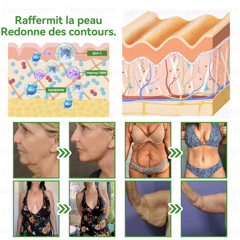 𝐵𝑜𝑢𝑡𝑖𝑞𝑢𝑒 𝑂𝑓𝑓𝑖𝑐𝑖𝑒𝑙𝑙𝑒 | 😇𝐃𝒊𝓪𝐩𝓪𝙨𝐨𝒏®Ｇ𝖫𝑃-𝟏 9 𝐸𝑁 1 𝑆𝑜𝑙𝑢𝑡𝑖𝑜𝑛 𝑆𝑎𝑛𝑡é 𝐋𝑖𝑞𝑢𝑖𝑑𝑒 𝐵𝑢𝑐𝑐𝑎𝑙𝑒—— 𝐹𝑜𝑟𝑚𝑢𝑙𝑒 𝑑𝑒 𝑝𝑟𝑜𝑡𝑒𝑐𝑡𝑖𝑜𝑛 𝑐𝑜𝑛𝑡𝑟𝑒 𝑙𝑒𝑠 𝑚𝑎𝑙𝑎𝑑𝑖𝑒𝑠 𝑐ℎ𝑟𝑜𝑛𝑖𝑞𝑢𝑒𝑠