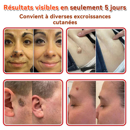 🌈𝐅𝐀𝐓𝐎𝐍𝐆®🍁💖𝐌𝐢𝐜𝐫𝐨-𝐀𝐢𝐠𝐮𝐢𝐥𝐥𝐞 𝐁𝐨𝐭𝐚𝐧𝐢𝐪𝐮𝐞 𝐏𝐚𝐭𝐜𝐡 𝐏𝐨𝐮𝐫 É𝐥𝐢𝐦𝐢𝐧𝐞𝐫 𝐋𝐞𝐬 𝐀𝐜𝐫𝐨𝐧𝐲𝐦𝐞𝐬 𝐂𝐮𝐭𝐚𝐧é𝐬 - 𝐔𝐧𝐞 𝐟𝐨𝐢𝐬 𝐩𝐚𝐫 𝐣𝐨𝐮𝐫, 𝐩𝐞𝐧𝐝𝐚𝐧𝐭 𝟔-𝟖 𝐡𝐞𝐮𝐫𝐞𝐬, é𝐥𝐢𝐦𝐢𝐧𝐞𝐳 𝐭𝐨𝐮𝐬 𝐥𝐞𝐬 𝐭𝐲𝐩𝐞𝐬 𝐝𝐞 𝐯𝐞𝐫𝐫𝐮𝐞𝐬 𝐜𝐮𝐭𝐚𝐧é𝐞𝐬 𝐞𝐧 𝐬𝐞𝐮𝐥𝐞𝐦𝐞𝐧𝐭 𝐒𝐲𝐧𝐭𝐚𝐱𝐞 𝐣𝐨𝐮𝐫𝐬