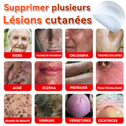 🌈𝐅𝐀𝐓𝐎𝐍𝐆®🍁💖𝐌𝐢𝐜𝐫𝐨-𝐀𝐢𝐠𝐮𝐢𝐥𝐥𝐞 𝐁𝐨𝐭𝐚𝐧𝐢𝐪𝐮𝐞 𝐏𝐚𝐭𝐜𝐡 𝐏𝐨𝐮𝐫 É𝐥𝐢𝐦𝐢𝐧𝐞𝐫 𝐋𝐞𝐬 𝐀𝐜𝐫𝐨𝐧𝐲𝐦𝐞𝐬 𝐂𝐮𝐭𝐚𝐧é𝐬 - 𝐔𝐧𝐞 𝐟𝐨𝐢𝐬 𝐩𝐚𝐫 𝐣𝐨𝐮𝐫, 𝐩𝐞𝐧𝐝𝐚𝐧𝐭 𝟔-𝟖 𝐡𝐞𝐮𝐫𝐞𝐬, é𝐥𝐢𝐦𝐢𝐧𝐞𝐳 𝐭𝐨𝐮𝐬 𝐥𝐞𝐬 𝐭𝐲𝐩𝐞𝐬 𝐝𝐞 𝐯𝐞𝐫𝐫𝐮𝐞𝐬 𝐜𝐮𝐭𝐚𝐧é𝐞𝐬 𝐞𝐧 𝐬𝐞𝐮𝐥𝐞𝐦𝐞𝐧𝐭 𝐒𝐲𝐧𝐭𝐚𝐱𝐞 𝐣𝐨𝐮𝐫𝐬